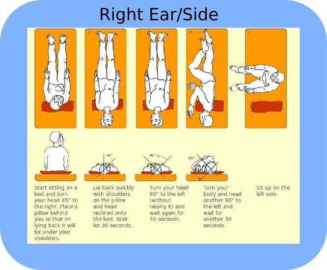 Printable Vertigo Exercises Pictures
