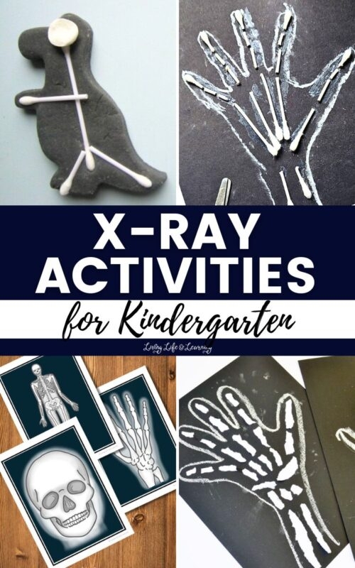 X ray Activities For Kindergarten