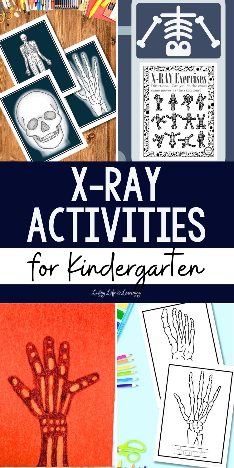prek x ray activities printable